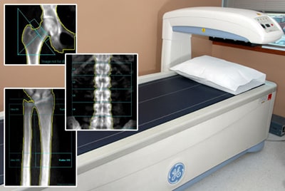 opg-image